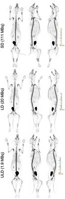 [18F] Sodium Fluoride Dose Reduction Enabled by Digital Photon Counting PET/CT for Evaluation of Osteoblastic Activity